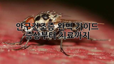 안구건조증 완벽 가이드: 증상부터 치료까지